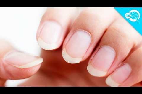 Manicure May Have Given Woman Cancer: 'It Hurt A Lot'