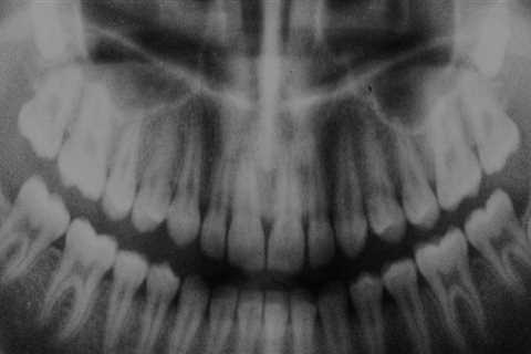 Unveiling the Different Types of Tests Used to Analyze Dental Evidence in Court