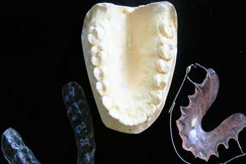 Unveiling the Secrets of Forensic Odontology