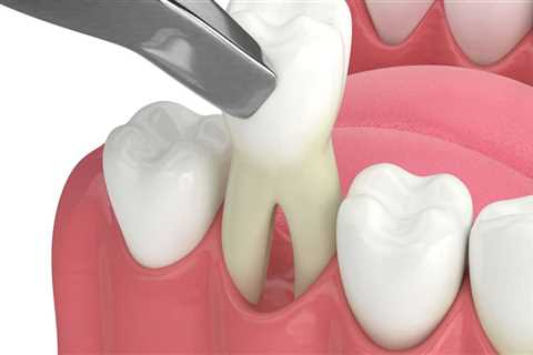 What to Do if You Experience Pain or Discomfort After Oral Surgery