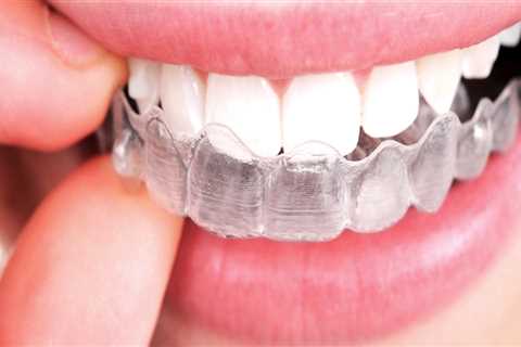 What To Expect When Your Dentist Has A Dental Assistant With Them During Your Invisalign Treatment..