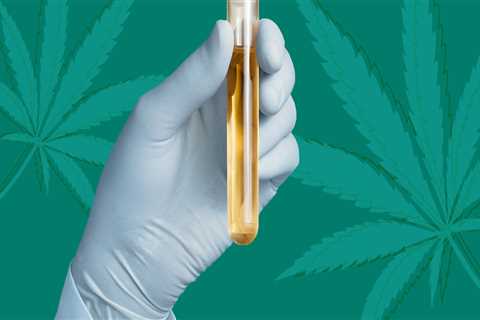 How long is cbd detectable in urine?