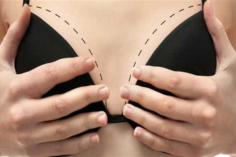 Why Medical Imaging Is Essential For Safe And Successful Breast Augmentation In Danville, CA