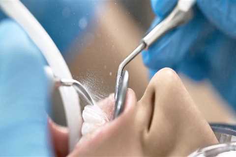 Can dental assistants clean teeth?