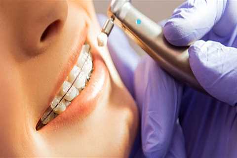 The Importance Of Early Orthodontic Intervention: Choosing A Pediatric Dentist For Your Kid's..