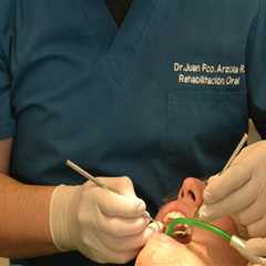 Beyond Teeth Whitening: Natural-Looking Custom Veneers in San Diego, CA for a Confident Smile