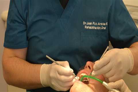 Beyond Teeth Whitening: Natural-Looking Custom Veneers in San Diego, CA for a Confident Smile