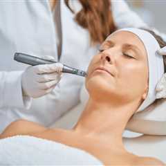 Microneedling Lake Mary FAQ: Expert Answers (2026)- Wellness Workers