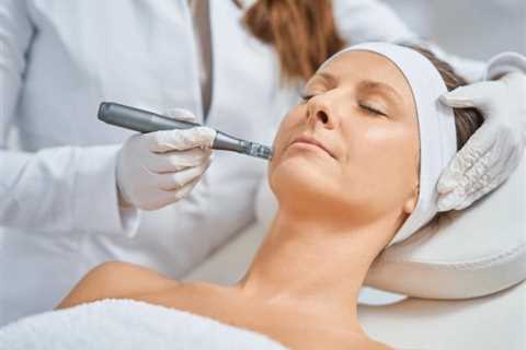 Microneedling Lake Mary FAQ: Expert Answers (2026)- Wellness Workers